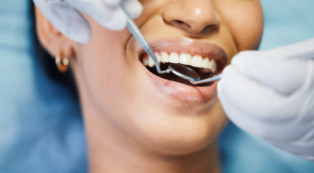 Best Knocked-Out Tooth Emergency  in Ivanhoe, CA
